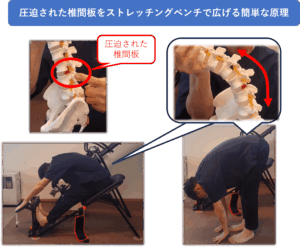 圧迫された椎間板をストレッチングベンチで広げる簡単な原理